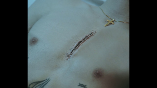 Video Reference: Branch, Twig, Organism, Wood, Insect, Plant, Stain, Pest, Fish, Macro photography