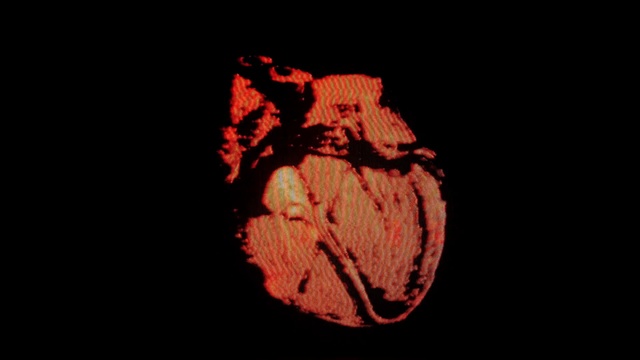 Video Reference: Cap, Heat, Art, Carmine, Font, Science, Astronomical object, Thread, Wood, Peach