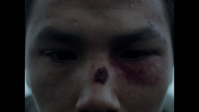 Video Reference: Nose, Cheek, Eyelash, Jaw, Ear, No expression, Snout, Art, Disfigurement, Whiskers