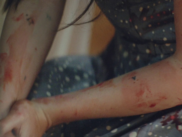 Video Reference: Joint, Skin, Hand, Arm, Eye, Shoulder, Mouth, Leg, Muscle, Leaf