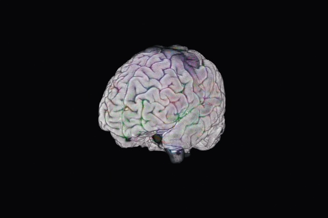 Video Reference: Brain, Plant, Brain, Bone, Circle, Symmetry, Art, Font, Glass, Pattern