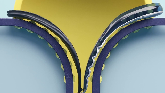 Video Reference: Hood, Automotive tire, Automotive lighting, Automotive design, Motor vehicle, Yellow, Gesture, Rim, Automotive exterior, Vehicle door