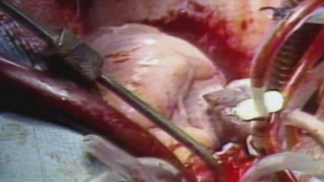 Video Reference: Food, Jaw, Recipe, Cuisine, Dish, Ingredient, Flesh, Terrestrial animal, Magenta, Macro photography