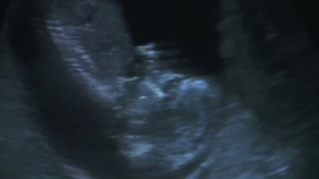 Video Reference: Tints and shades, Electric blue, Pattern, Font, Darkness, Macro photography, Metal, Monochrome photography, Mesh, Circle