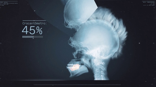 Video Reference: Jaw, Flash photography, X-ray, Font, Electric blue, Art, Smoke, Darkness, Bone, Radiography