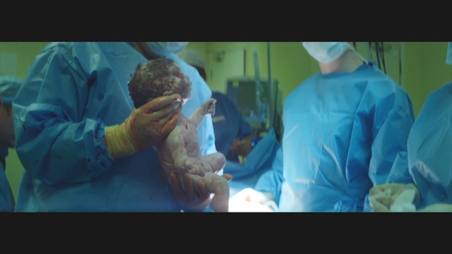 Video Reference: Jaw, Medical glove, Sleeve, Gesture, Scrubs, Health care provider, Medical procedure, Surgeon, Health care, Glove