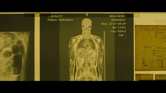 Video Reference: Joint, Arm, Shoulder, Human, Human body, Neck, Jaw, Sleeve, Medical imaging, Organism