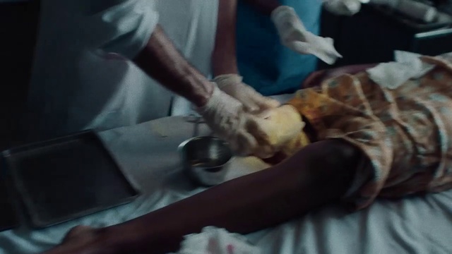 Video Reference: Hand, Safety glove, Finger, Medical procedure, Wrist, Medical, Nail, Health care, Service, Medical glove