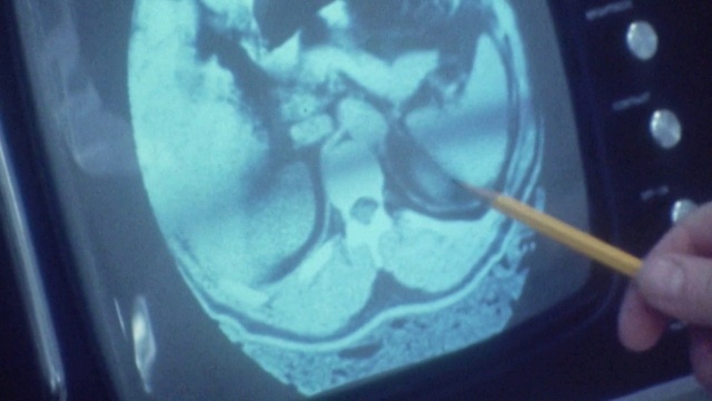 Video Reference: Hand, Window, Organism, Aqua, Electric blue, Motor vehicle, Vehicle door, Circle, Glass, Auto part