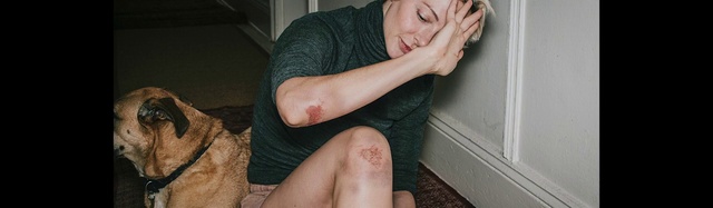 Video Reference: Joint, Skin, Hand, Shoulder, Arm, Smile, Muscle, Leg, Mouth, Comfort