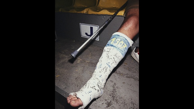 Video Reference: Handwriting, Knee, Gesture, Finger, Thigh, Font, Road surface, Wrist, Nail, Elbow