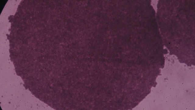Video Reference: Purple, Pink, Magenta, Tints and shades, Chemical compound, Carmine, Pattern, Electric blue, Circle, Wool