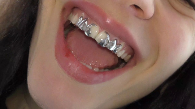 Video Reference: Cheek, Lip, Tooth, Eyelash, Mouth, Tongue, Jaw, Fluid, Cosmetic dentistry, Liquid