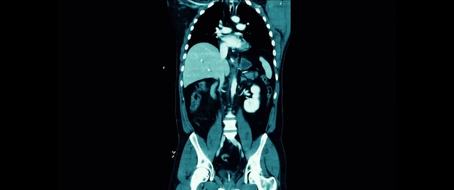 Video Reference: Sleeve, Art, Font, Electric blue, T-shirt, Darkness, Fictional character, Event, Visual arts, Graphics