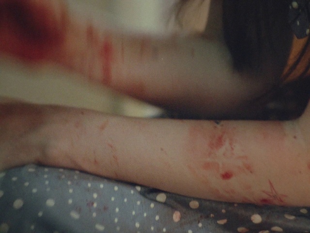 Video Reference: Skin, Head, Scar, Knee, Gesture, Finger, Elbow, Eyelash, Thigh, Wrist