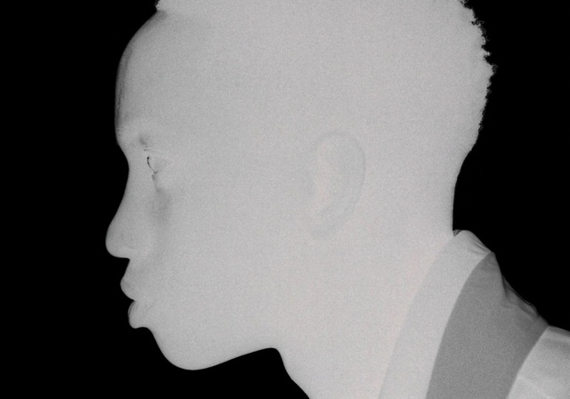 Video Reference: Nose, Head, Lip, Eyebrow, Eye, Mouth, Ear, Jaw, Eyelash, Flash photography