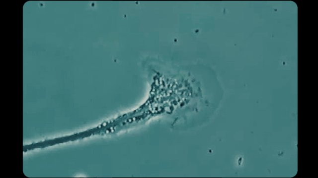 Video Reference: microscope, cell, microbiology, particle, biology, lab, close-up, teal, specimen, microscopic, abstract, science