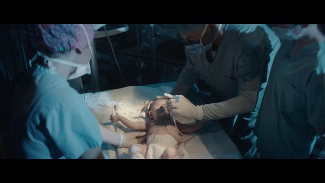 Video Reference: Health care provider, Medical equipment, Medical glove, Safety glove, Surgeon, Health care, Medical procedure, Jaw, Medical, Medical assistant