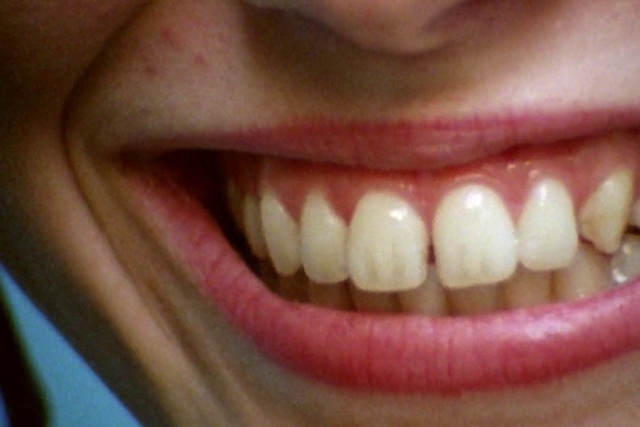 Video Reference: Lip, Eyebrow, Mouth, Human body, Jaw, Material property, Happy, Cosmetic dentistry, Tints and shades, Tooth