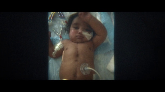 Video Reference: Flash photography, Jaw, Ear, Neck, Gesture, Stomach, Chest, Eyelash, Trunk, Abdomen