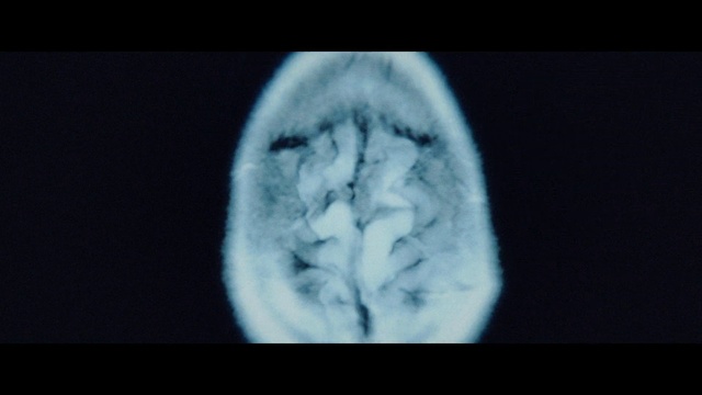 Video Reference: Head, Eye, Human body, Jaw, Medical, Font, Service, Obstetric ultrasonography, Electric blue, Medical imaging