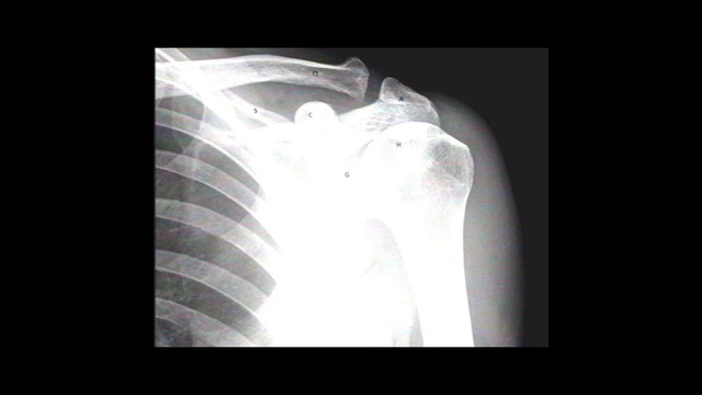 Video Reference: Head, X-ray, Leg, Radiography, Medical imaging, Human body, Jaw, Medical, Radiology, Gesture