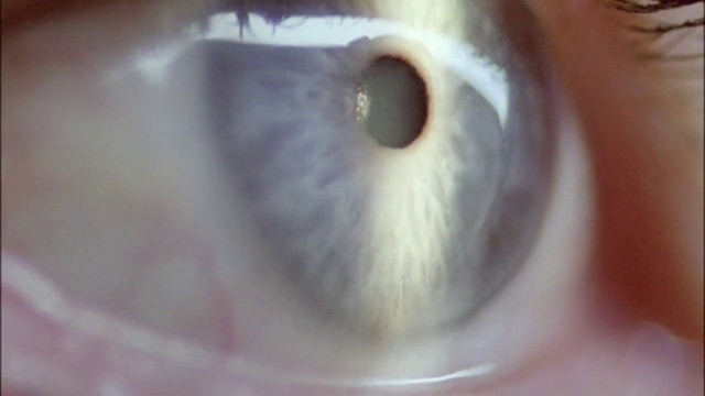 Video Reference: Eyelash, Human body, Iris, Ear, Snout, Circle, Whiskers, Macro photography, Science, Fur