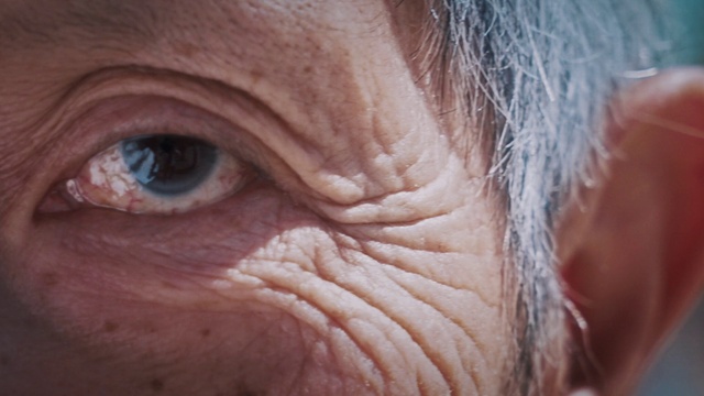 Video Reference: Nose, Cheek, Eyelash, Human body, Iris, Liver, Wrinkle, Snout, Wood, Close-up